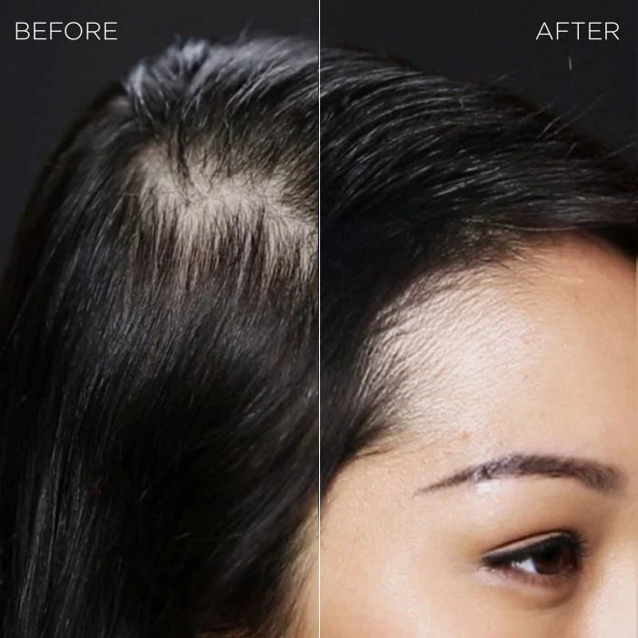 Toppik Hair Building Fibers and Thinning BLACK 27.5g