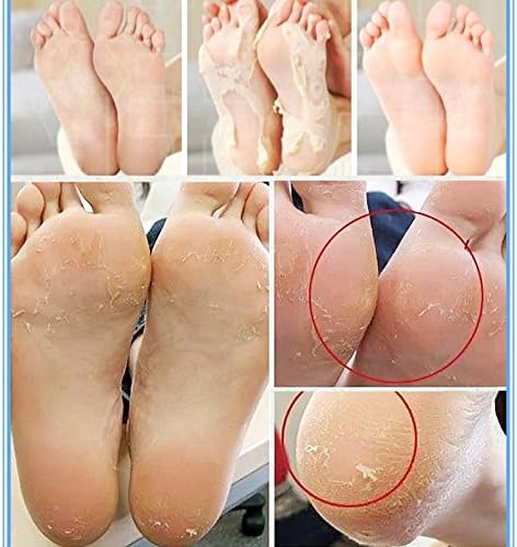MBeauty Exfoliating Magic Foot Socks 40g, Softens & Removes Dead Calluses, Infused With Natural Ingredients, Single Use Socks