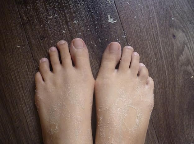 MBeauty Exfoliating Magic Foot Socks 40g, Softens & Removes Dead Calluses, Infused With Natural Ingredients, Single Use Socks