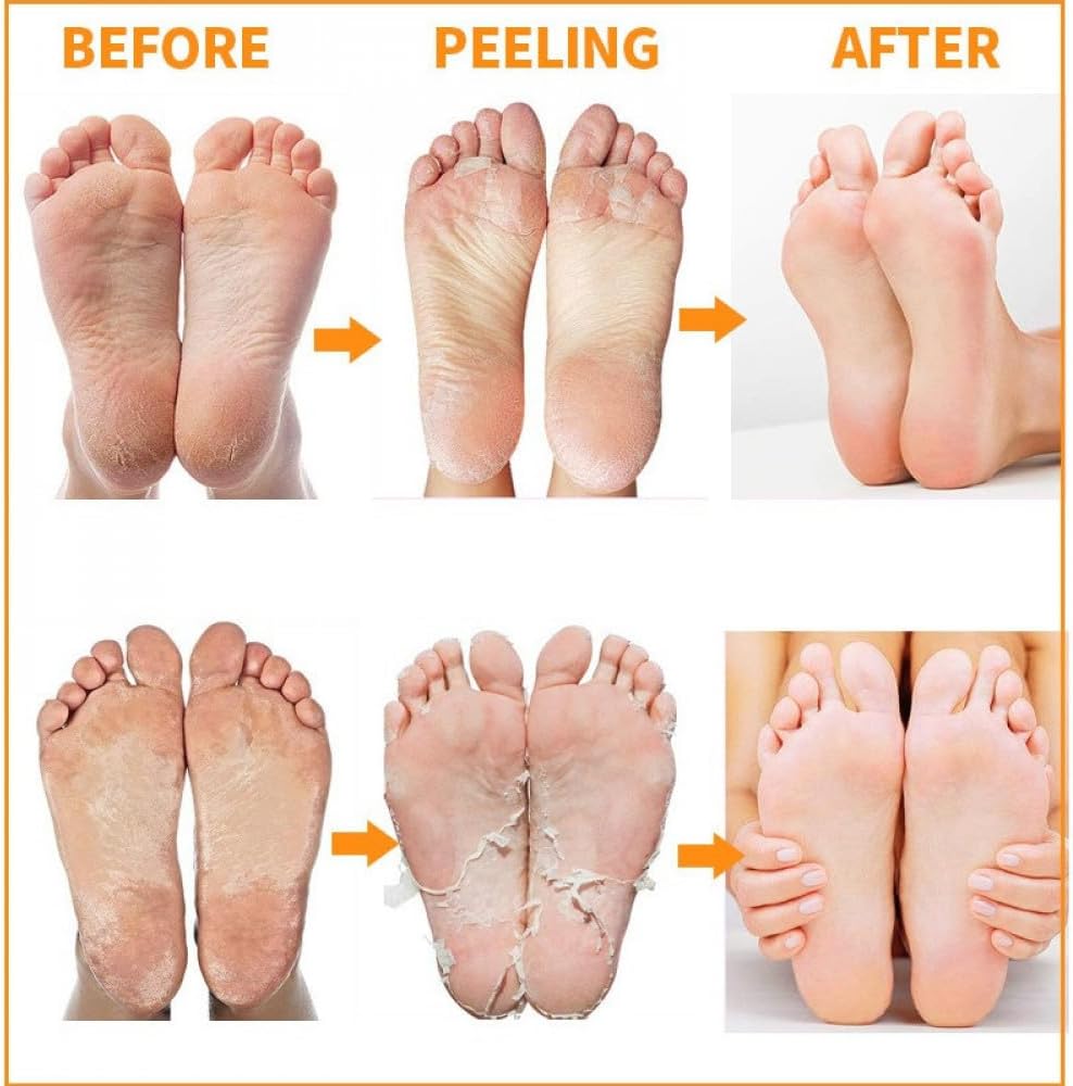 MBeauty Exfoliating Magic Foot Socks 40g, Softens & Removes Dead Calluses, Infused With Natural Ingredients, Single Use Socks