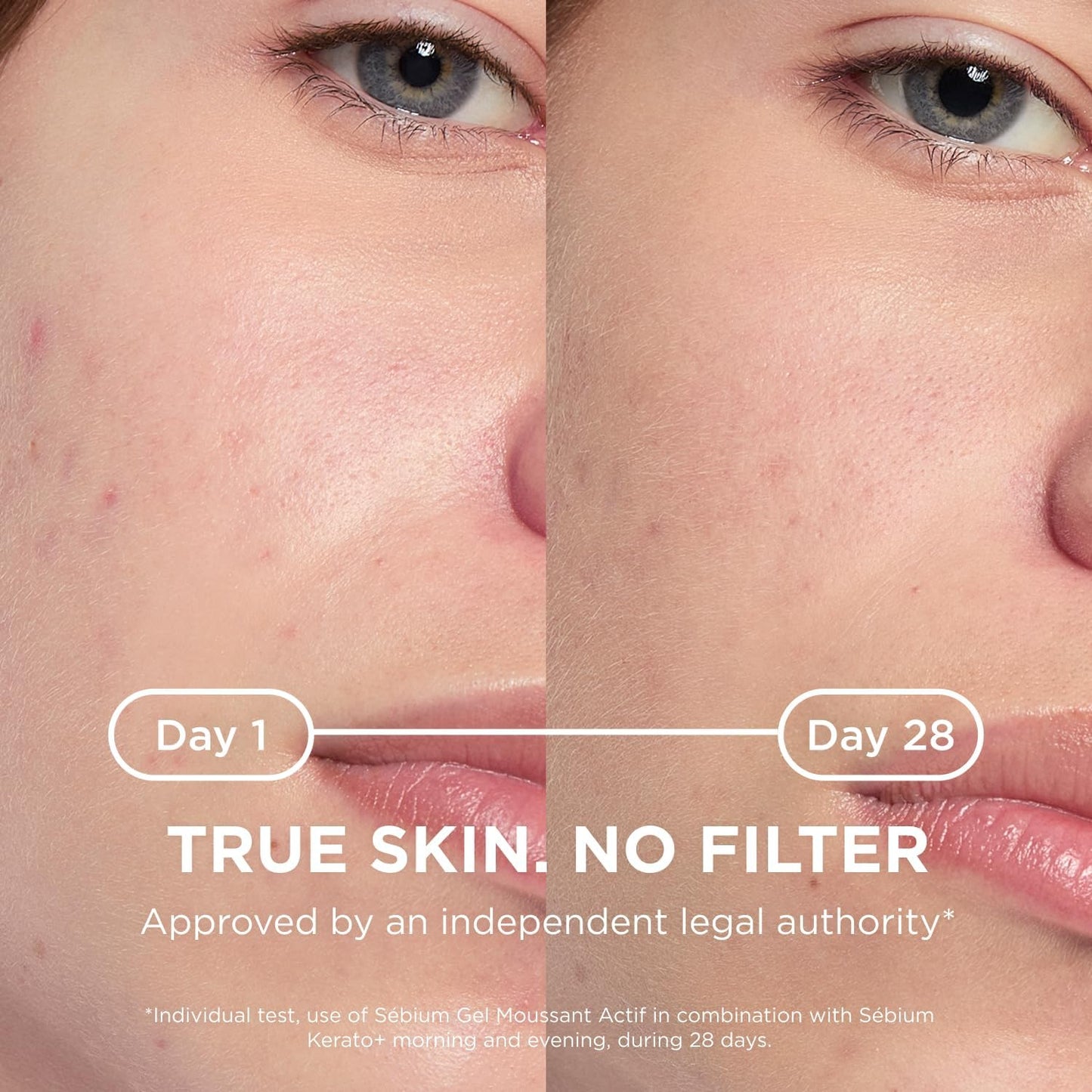 Bioderma Sebium Kerato -Te30Ml