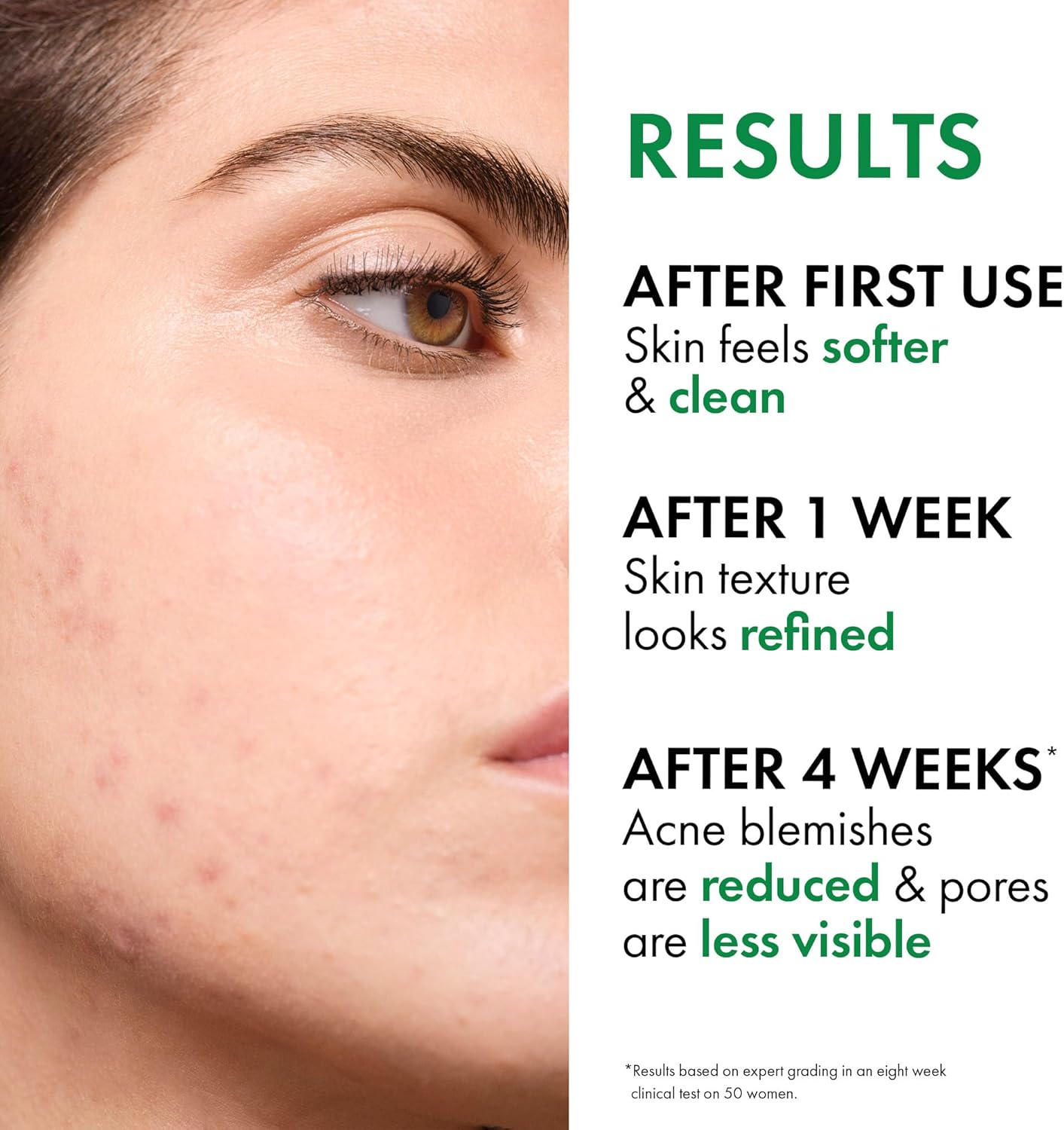 Vichy Normaderm Double Correction 50Ml