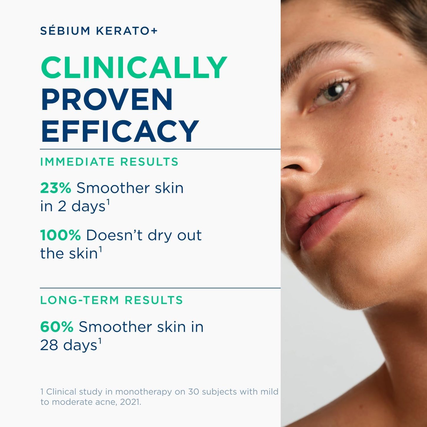 Bioderma Sebium Kerato -Te30Ml