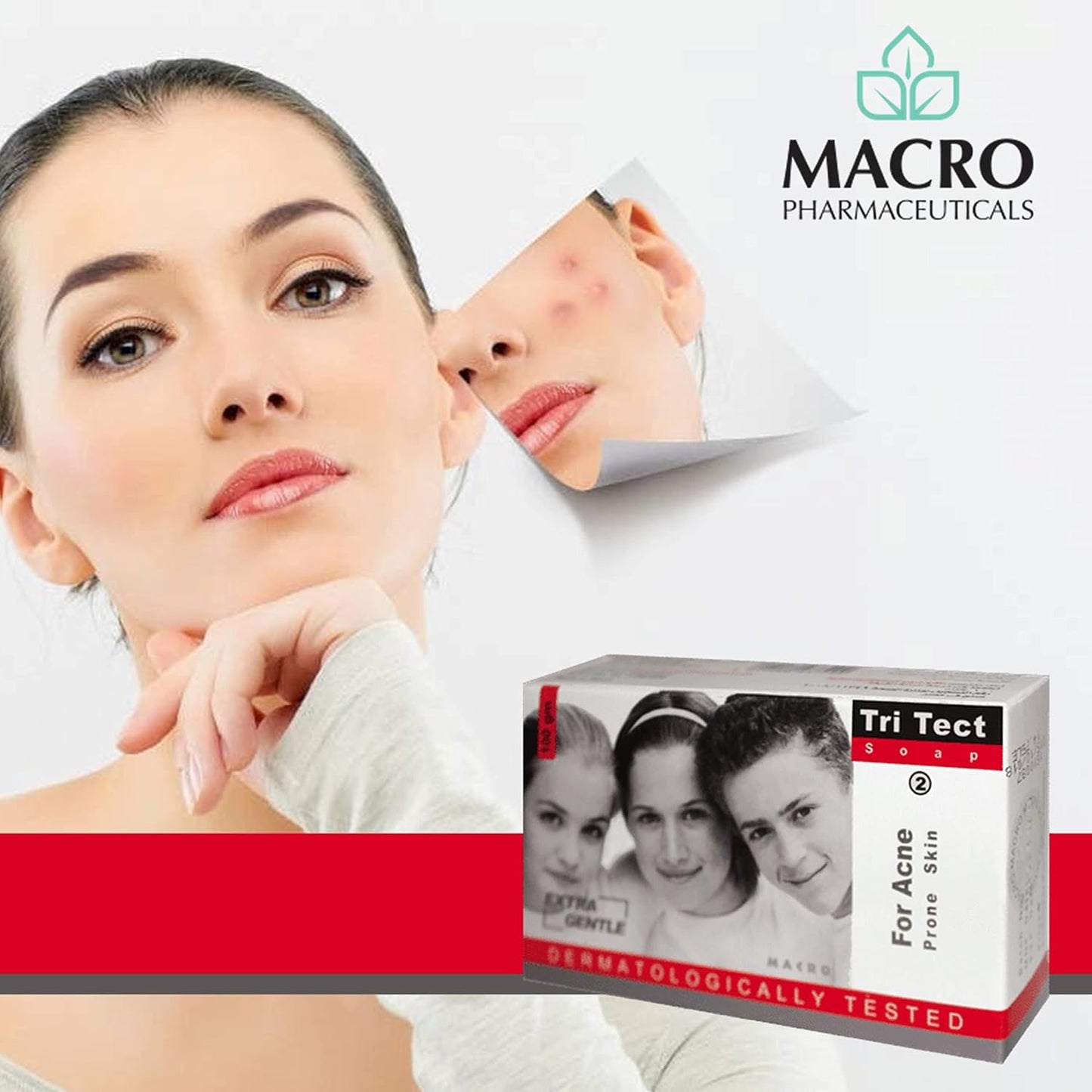 Macro tri tect extra gentle for acne- no. 2-100gm