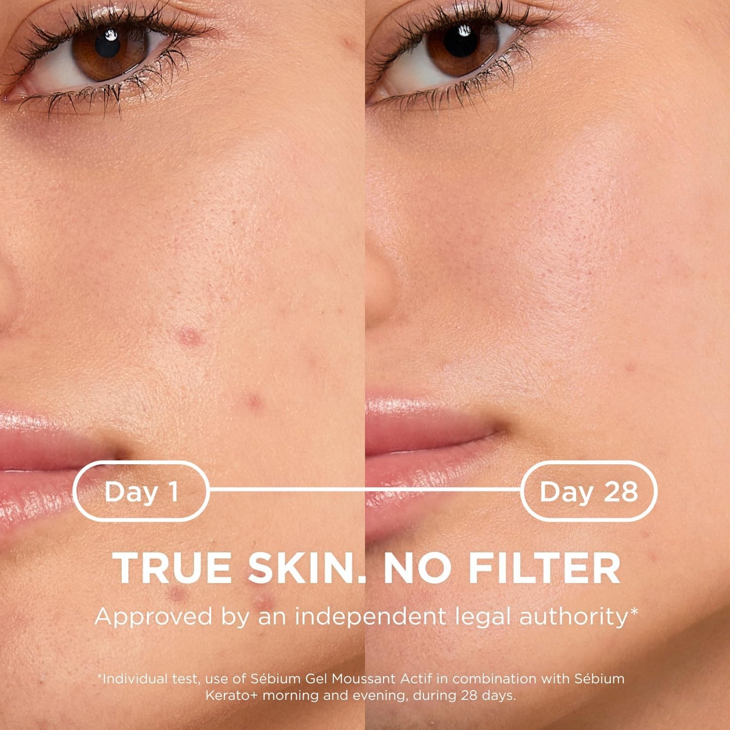 Bioderma Sebium Kerato -Te30Ml