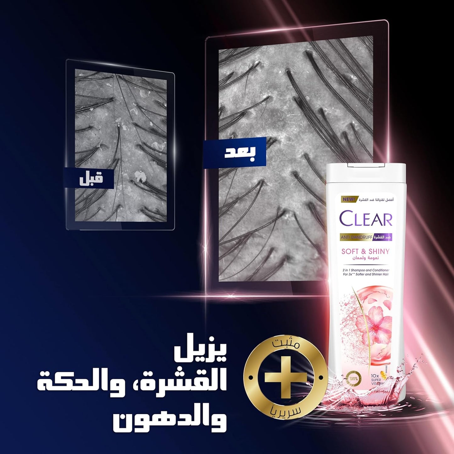 CLEAR Anti Dandruff 2IN1 Shampoo and Conditioner Soft & Shiny, for 3X softer and shiner hair, 360ML