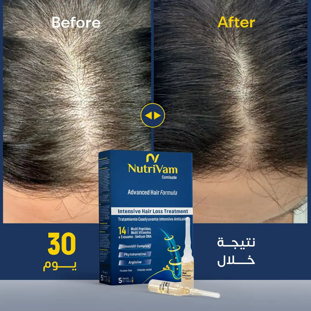 Nutrivam Advanced Anti-Hair Loss Ampouls 5Ml - 5 Ampoul