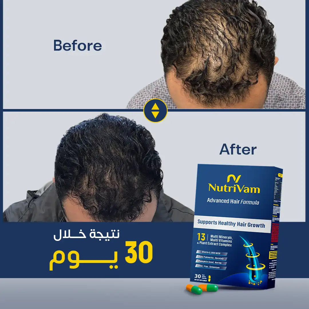Nutrivam Advanced Hair Formula-30 Capsule