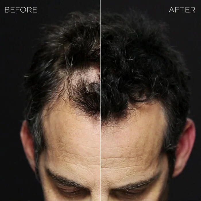 Toppik Hair Building Fibers and Thinning DARK BROWN 27.5g