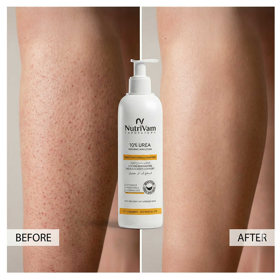 Nutrivam 10% Urea Repairing Lotion