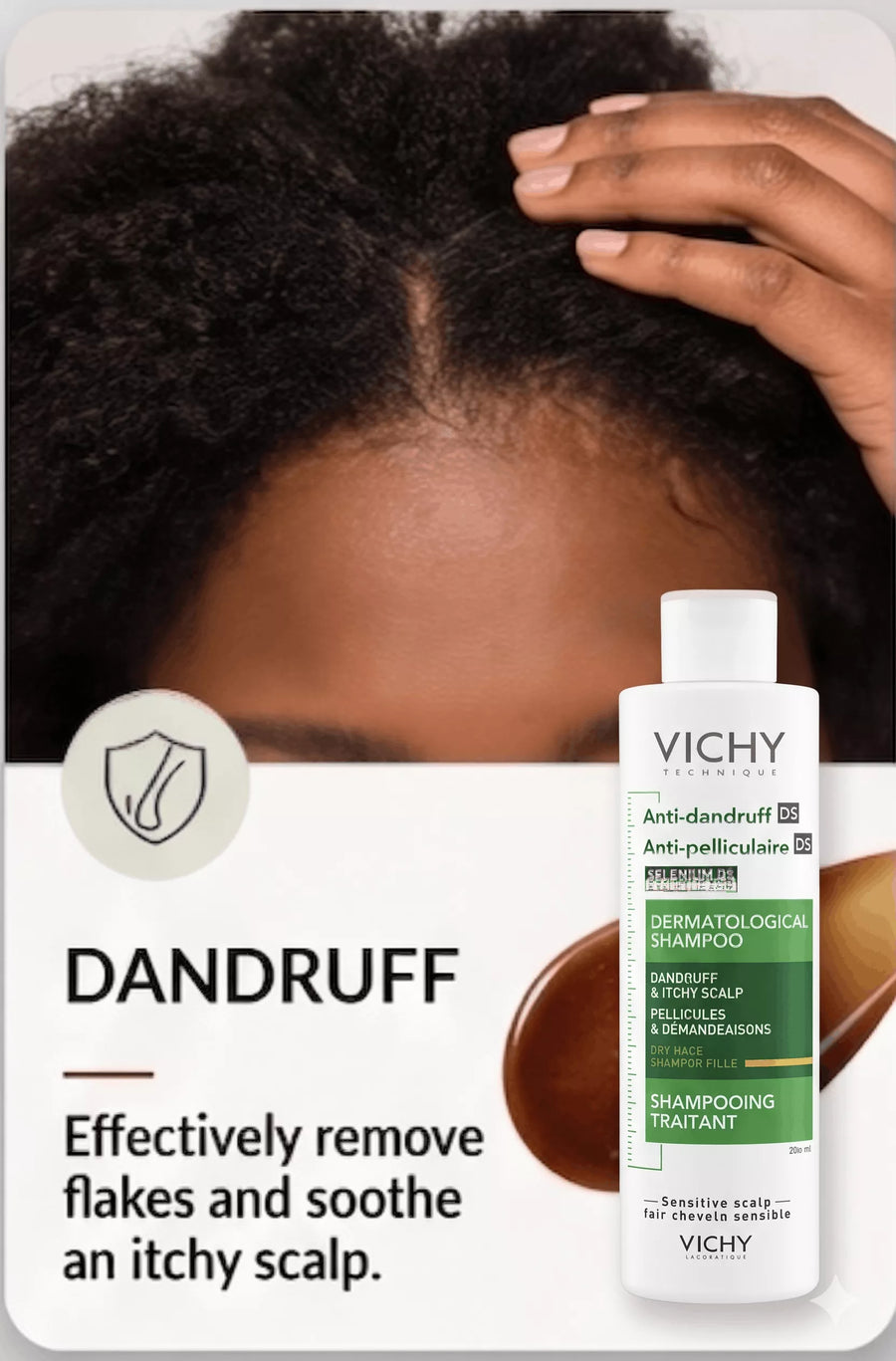 Dandruff