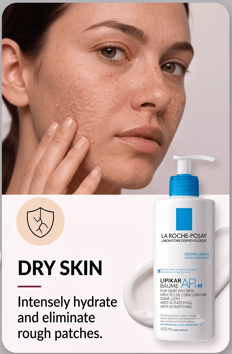 Dry skin