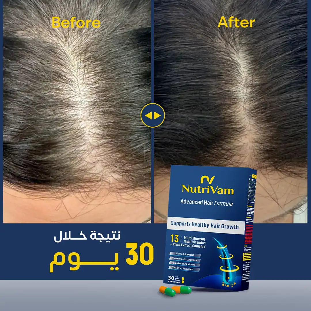 Nutrivam Advanced Hair Formula-30 Capsule
