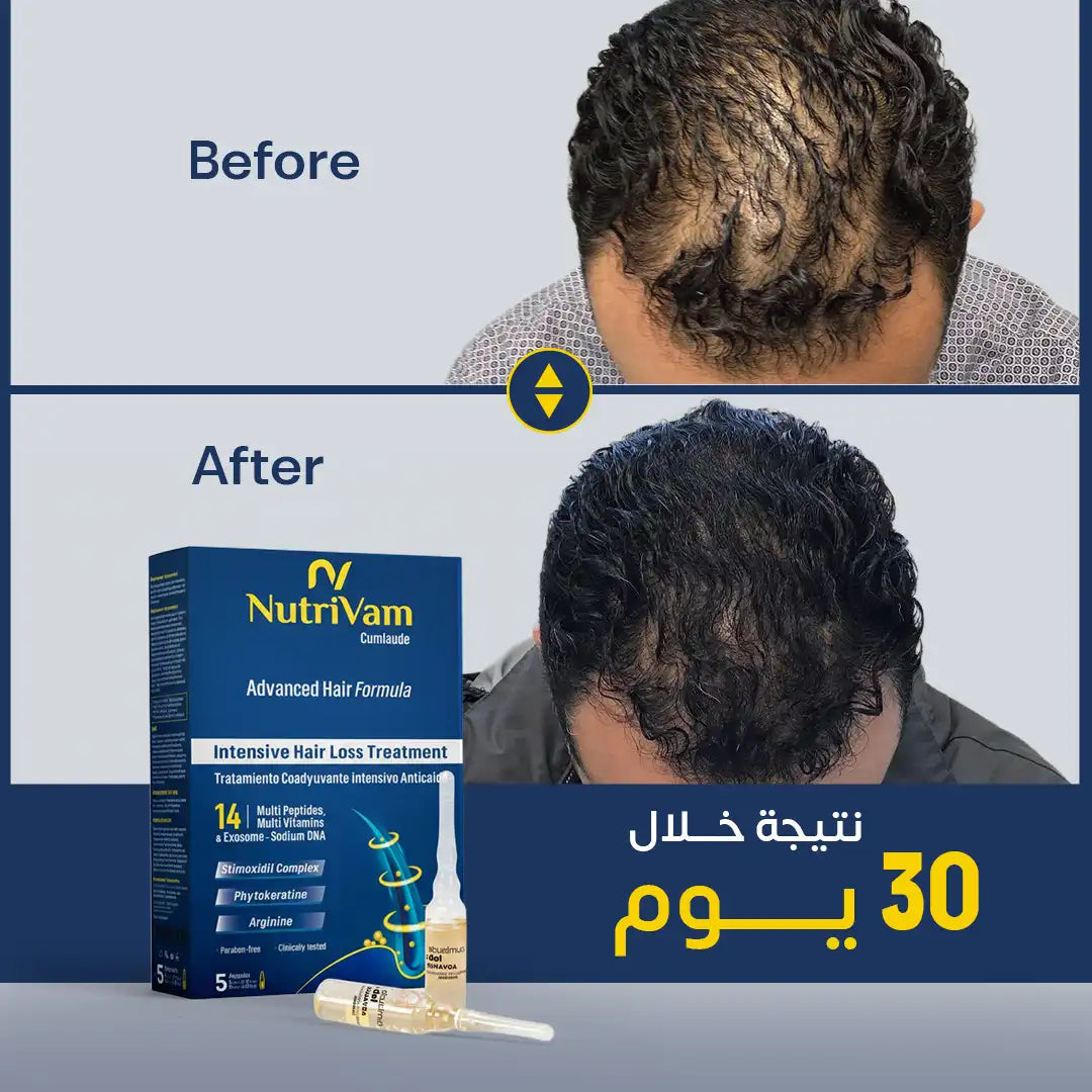 Nutrivam Advanced Anti-Hair Loss Ampouls 5Ml - 5 Ampoul